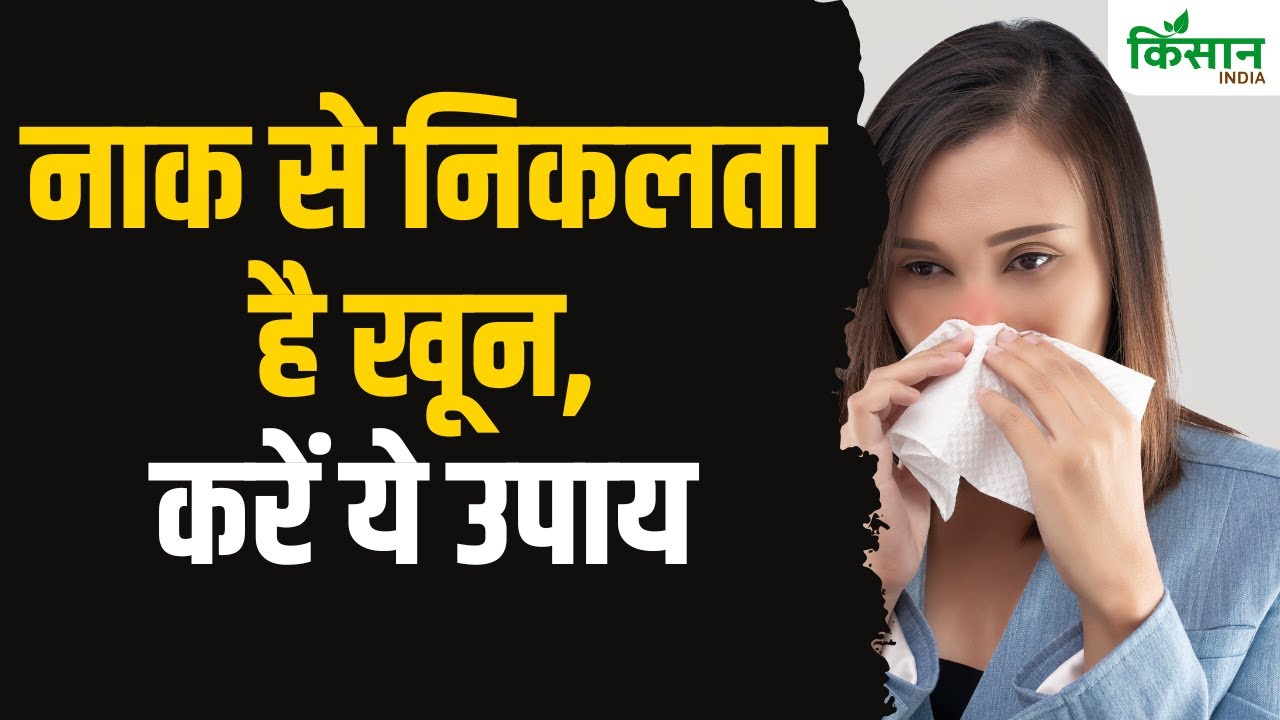 गर्मियों में नाक से निकलता है खून, करें ये उपाय
